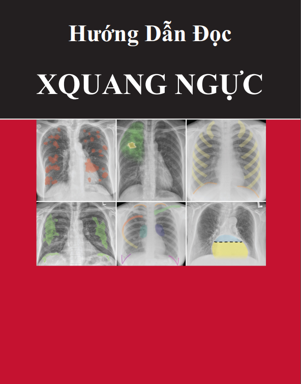 [VIP] Hướng dẫn đọc Xquang ngực
